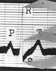 ecg1.jpg ecg1.jpg