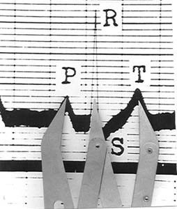 ecg2.jpg ecg2.jpg