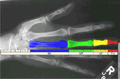 fib_hand