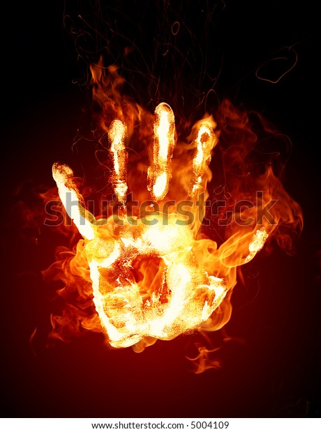 burning-hand-600w-5004109.jpg